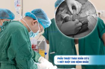 PHẪU THUẬT THÁO XOẮN CỨU 1 MÉT RUỘT CHO BỆNH NHÂN