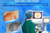 NỘI SOI CAN THIỆP: KỸ THUẬT THẮT ENDOLOOP TRONG XỬ LÝ POLYP KÍCH THƯỚC LỚN