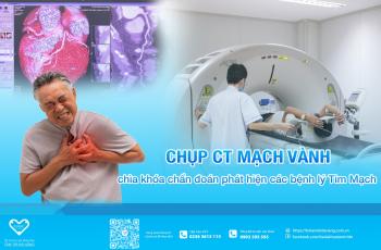 Chụp CT Mạch Vành - chìa khóa chẩn đoán phát hiện các bệnh lý Tim Mạch