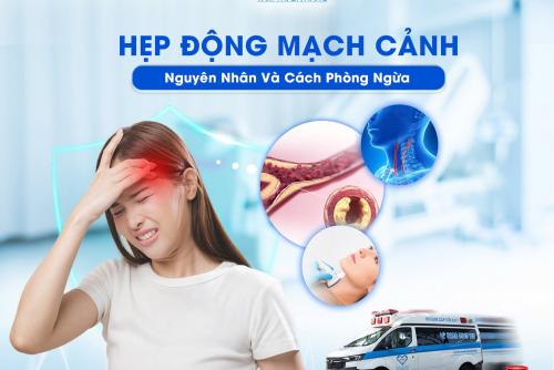 HẸP ĐỘNG MẠCH CẢNH NGUYÊN NHÂN VÀ CÁCH PHÒNG NGỪA
