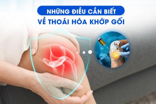 [KIẾN THỨC Y KHOA] NHỮNG ĐIỀU CẦN BIẾT VỀ THOÁI HÓA KHỚP GỐI