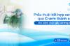 Phẫu thuật kết hợp xương qua C-arm thành công cho bệnh nhân gãy xương đòn