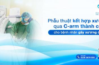 Phẫu thuật kết hợp xương qua C-arm thành công cho bệnh nhân gãy xương đòn