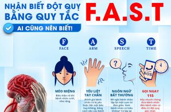 NHẬN BIẾT ĐỘT QUỴ BẰNG QUY TẮC FAST
