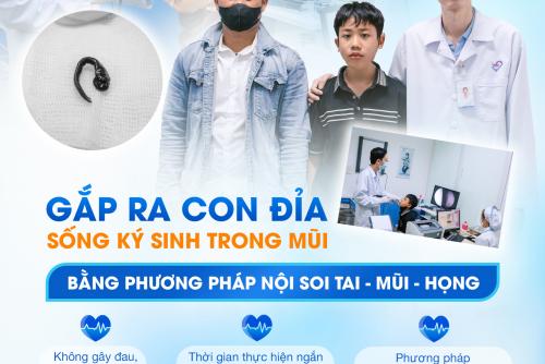 NỘI SOI GẮP THÀNH CÔNG VẮT CÒN SỐNG TRONG MŨI NAM THIẾU NIÊN 15 TUỔI SAU KHI TẮM SUỐI