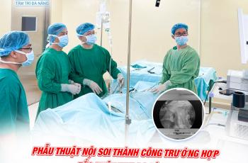 PHẪU THUẬT NỘI SOI THÀNH CÔNG TRƯỜNG HỢP TẮC RUỘT NON DO DÍNH